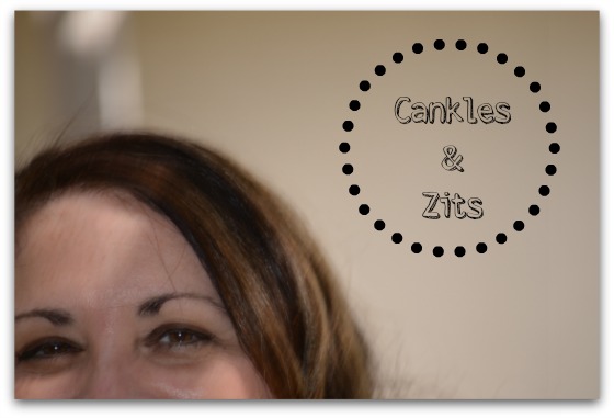 Cankles and Zits